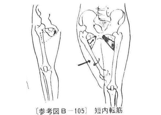 〔参考図B―105〕 短内転筋