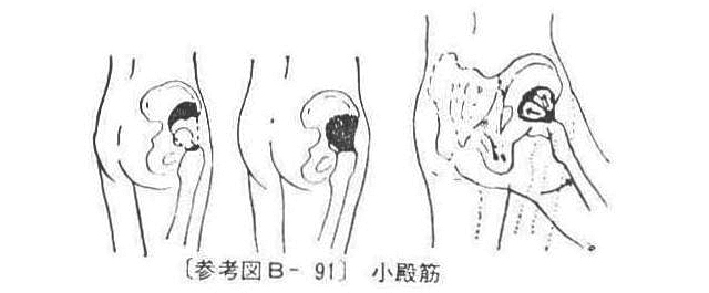〔参考図B―91〕 小殿筋