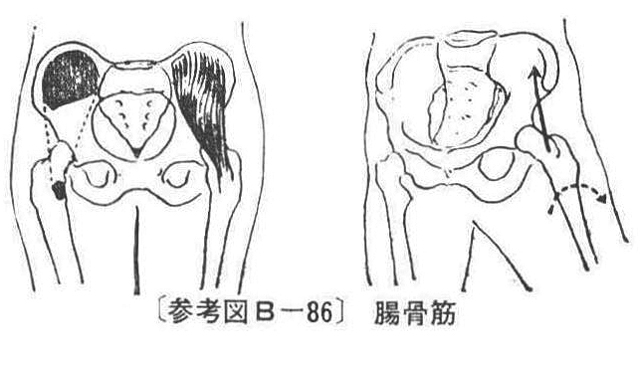 〔参考図B―86〕 腸骨筋