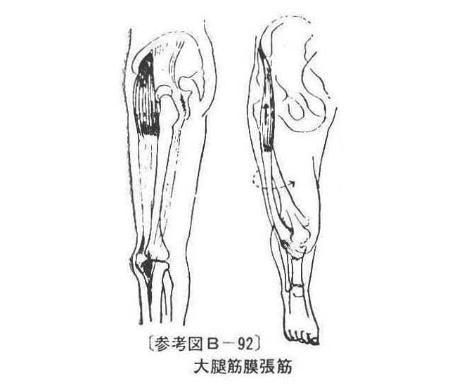 〔参考図B―92〕 大腿筋膜張筋