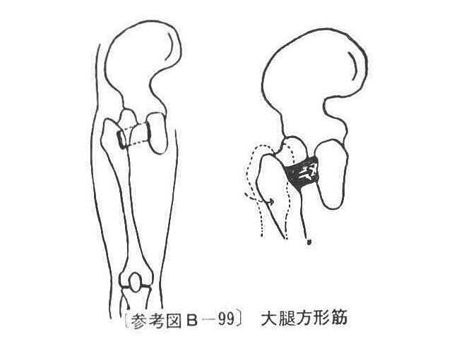〔参考図B―99〕 大腿方形筋