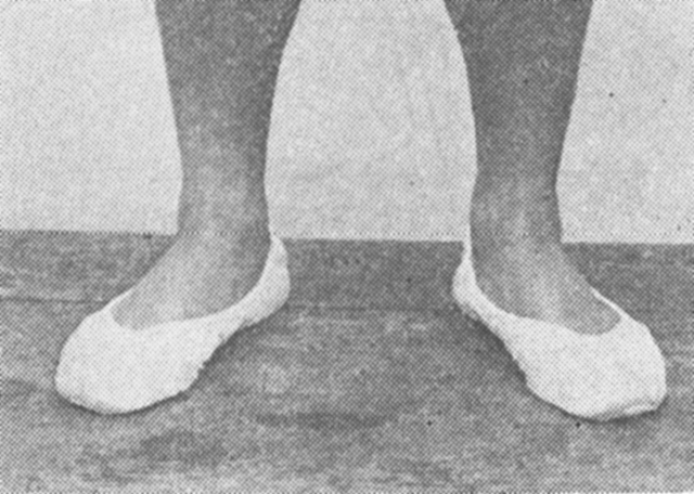〔写真11〕体操用シューズ