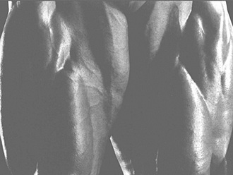 Top