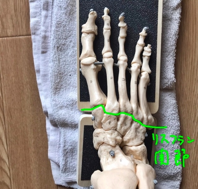 場所をずらしてリスフラン関節。こちらの方がショパール関節よりも動きが出やすいが、どちらの関節も足裏のアーチの構成に深く関わる。