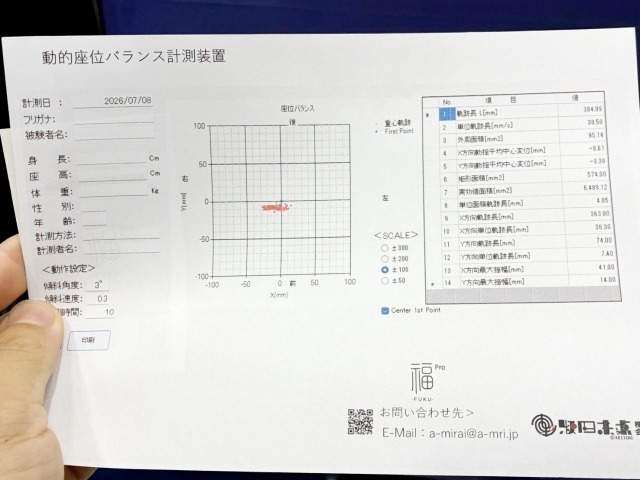 結果。赤い点が散らずに密集するほど良い。多少左右差はあるが悪くはないとのこと。術後やリハビリの効果測定などでの導入が望ましい。ちなみに一台およそ300万円。